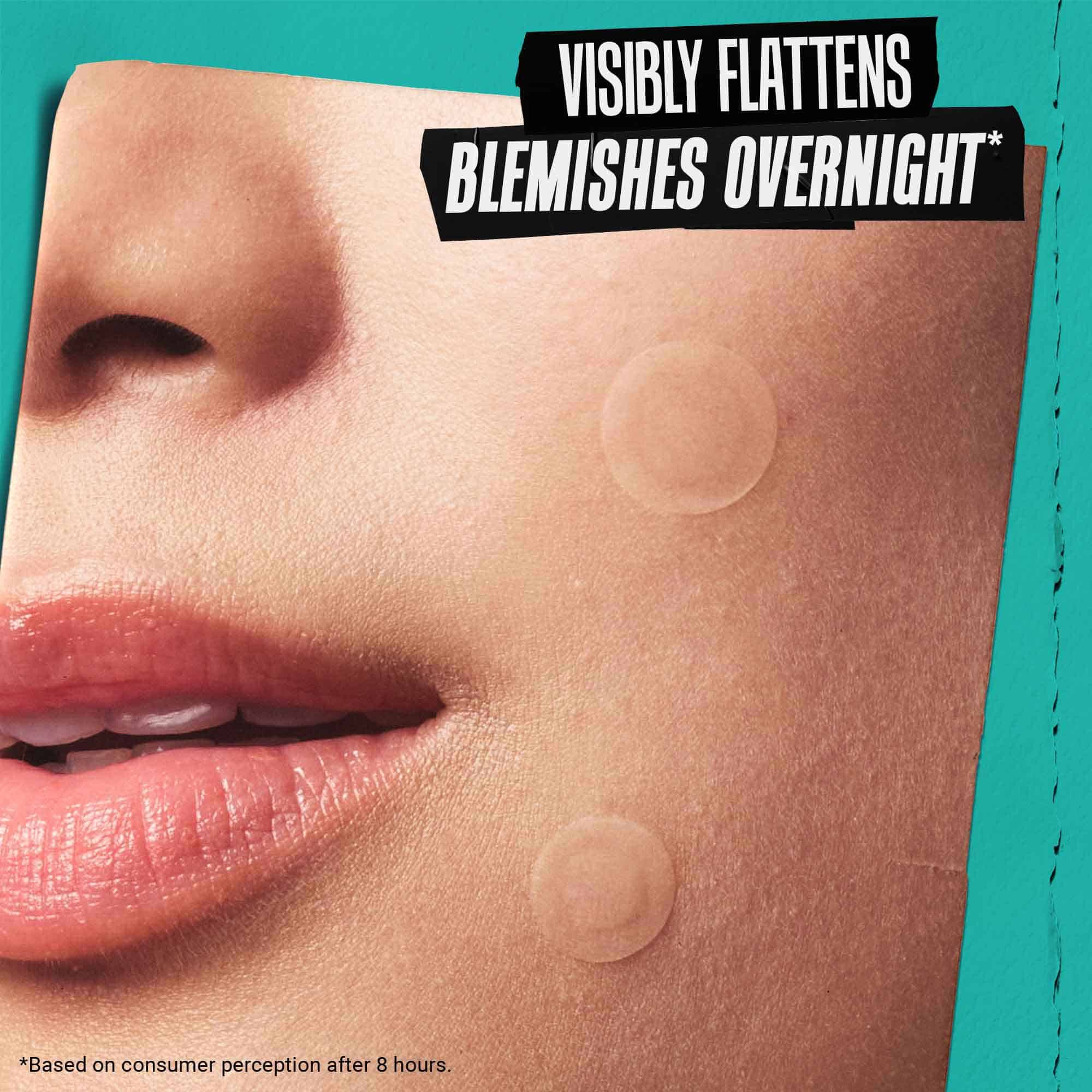 Truly Targeted Overnight Blemish Patch — Targeted Physical